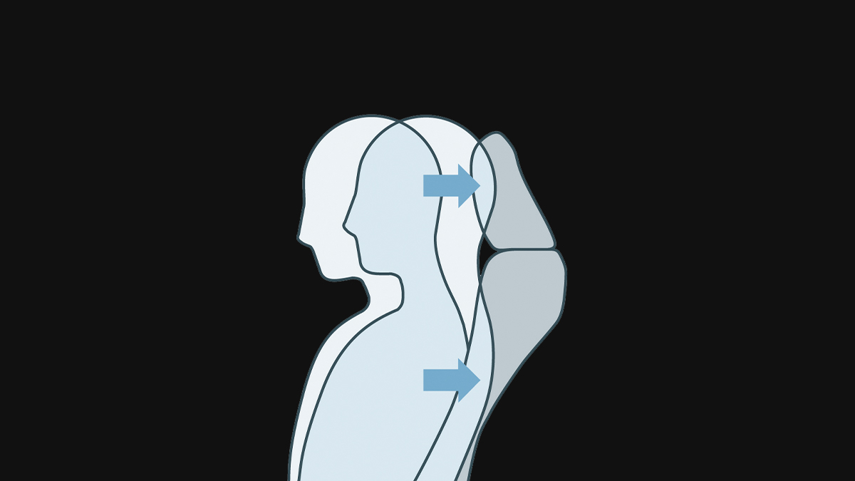 Whiplash Injury Lessening Seat